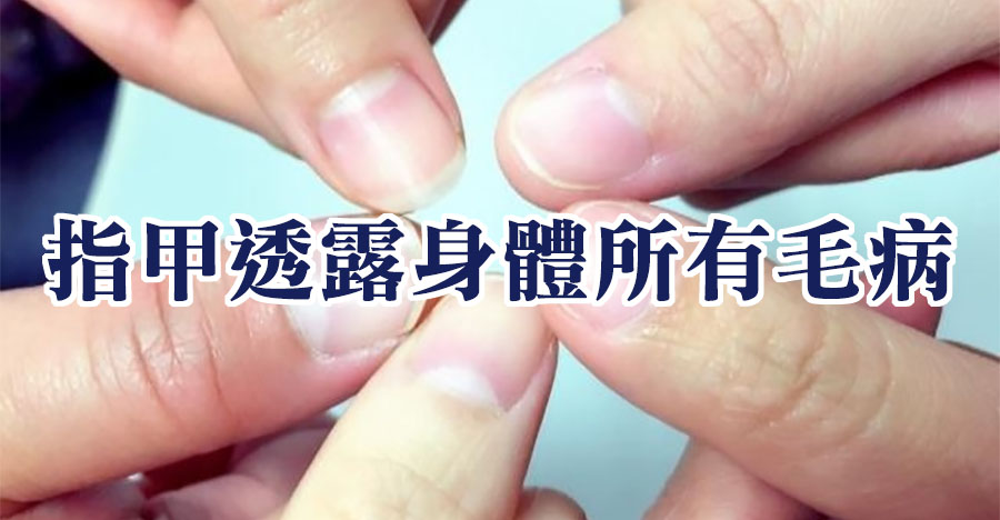 指甲透露身體所有毛病