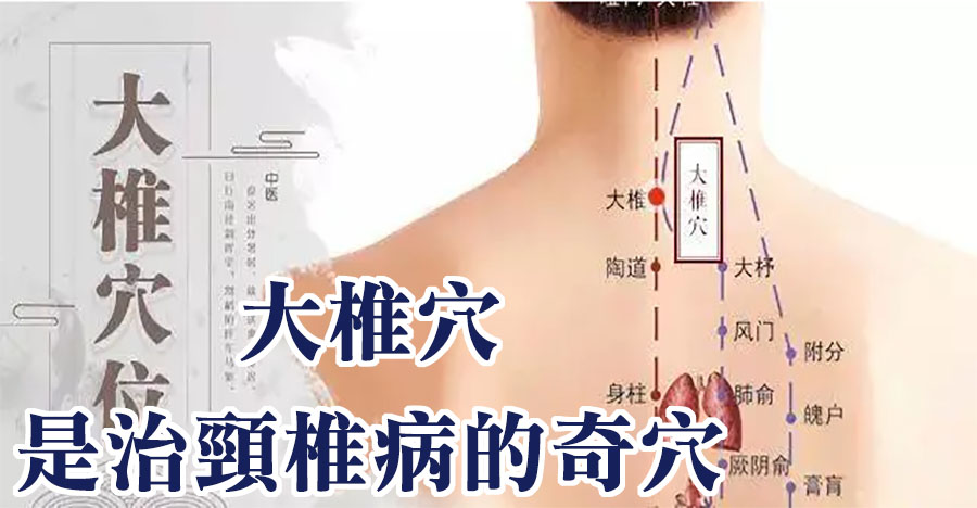 大椎穴，是治頸椎病的奇穴