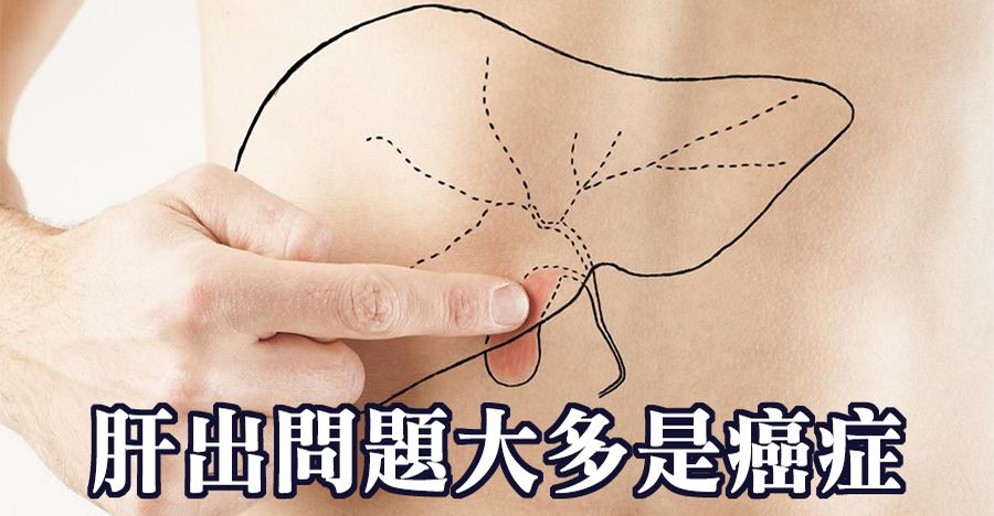 肝出問題大多是癌症