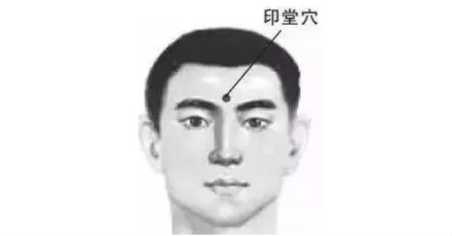 印堂穴