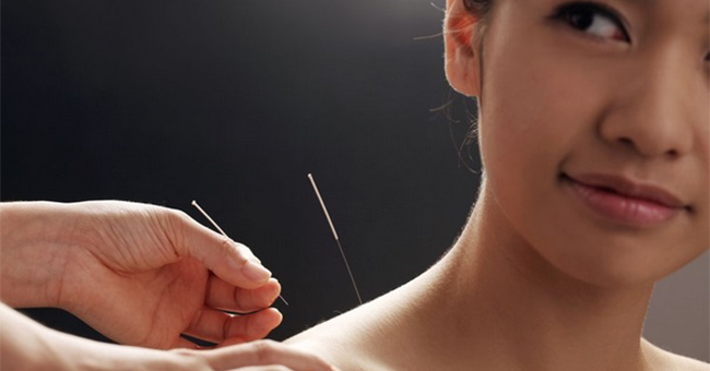 針灸
